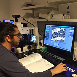 Quantification of Fluorescent Immunolabeling in Rat Hippocampus