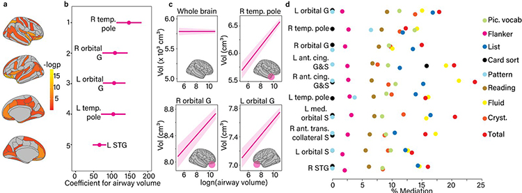 Airway volume predicts regional gray matter and cognition, and the brain sits in between. Larger airway volume was associated with larger temporal pole and orbitofrontal gray matter (a–c) and with higher scores on eight of ten NIH Toolbox cognitive tests. Mediation analysis (d) shows that frontal and temporal gray matter volumes carried a measurable share of the airway–cognition association, supporting a structural pathway rather than a purely behavioral one. Kanhere, Navarathna, et al., Am J Respir Crit Care Med, 2025.