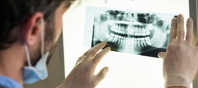 Dentist Examining an X-Ray
