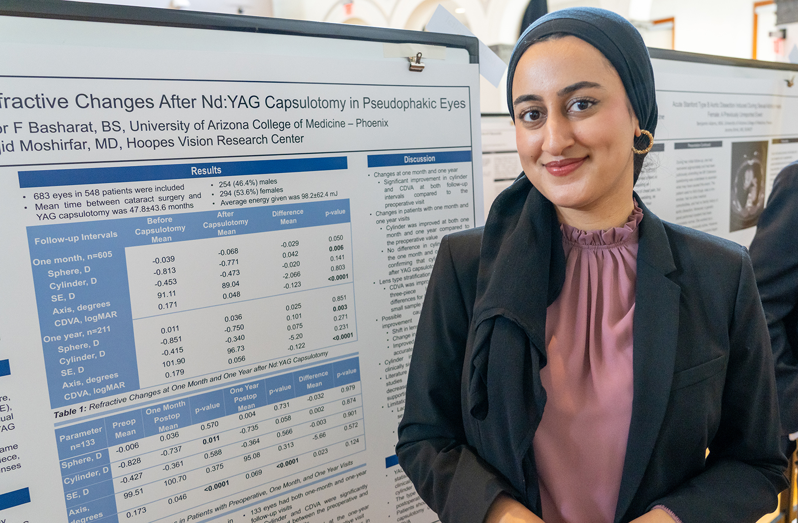 Noor Basharat's research focused on posterior capsular opacification, a common complication of cataract surgery. Noor Basharat's research focused on posterior capsular opacification, a common complication of cataract surgery.