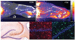 The Department of Translational Neurosciences advances new models, causes and treatments for most severe forms of head injury 