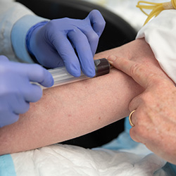 Blood being drawn in the lab as part of a clinical study