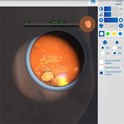 Screenshot of an Eyesi Indirect simulator showing the examination of a virtual Zika patient
