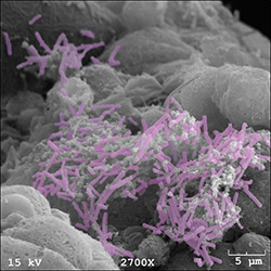 Endometrial cells colonized with “good” bacteria called Lactobacillus crispatus (colored purple), courtesy of the Herbst-Kralovetz lab.