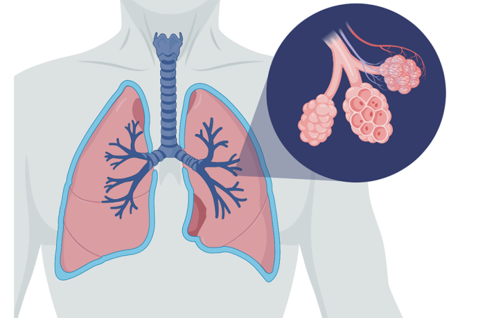 A graphic of the lungs