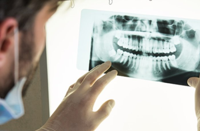 Dentist Examining an X-Ray