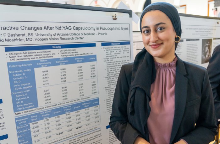 Noor Basharat's research focused on posterior capsular opacification, a common complication of cataract surgery.
