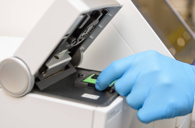 A bioinformatician, Tobias Jakobi, PhD, uses big data to inform translational research A bioinformatician, Tobias Jakobi, PhD, uses big data to inform translational research