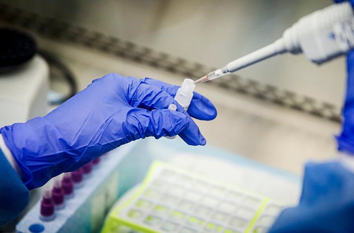 The University of Arizona has accepted a multi-million dollar grant from the CDC to conduct research on the impact of long-haul COVID-19 on the body (John Minchillo | AP) The University of Arizona has accepted a multi-million dollar grant from the CDC to conduct research on the impact of long-haul COVID-19 on the body (John Minchillo | AP)